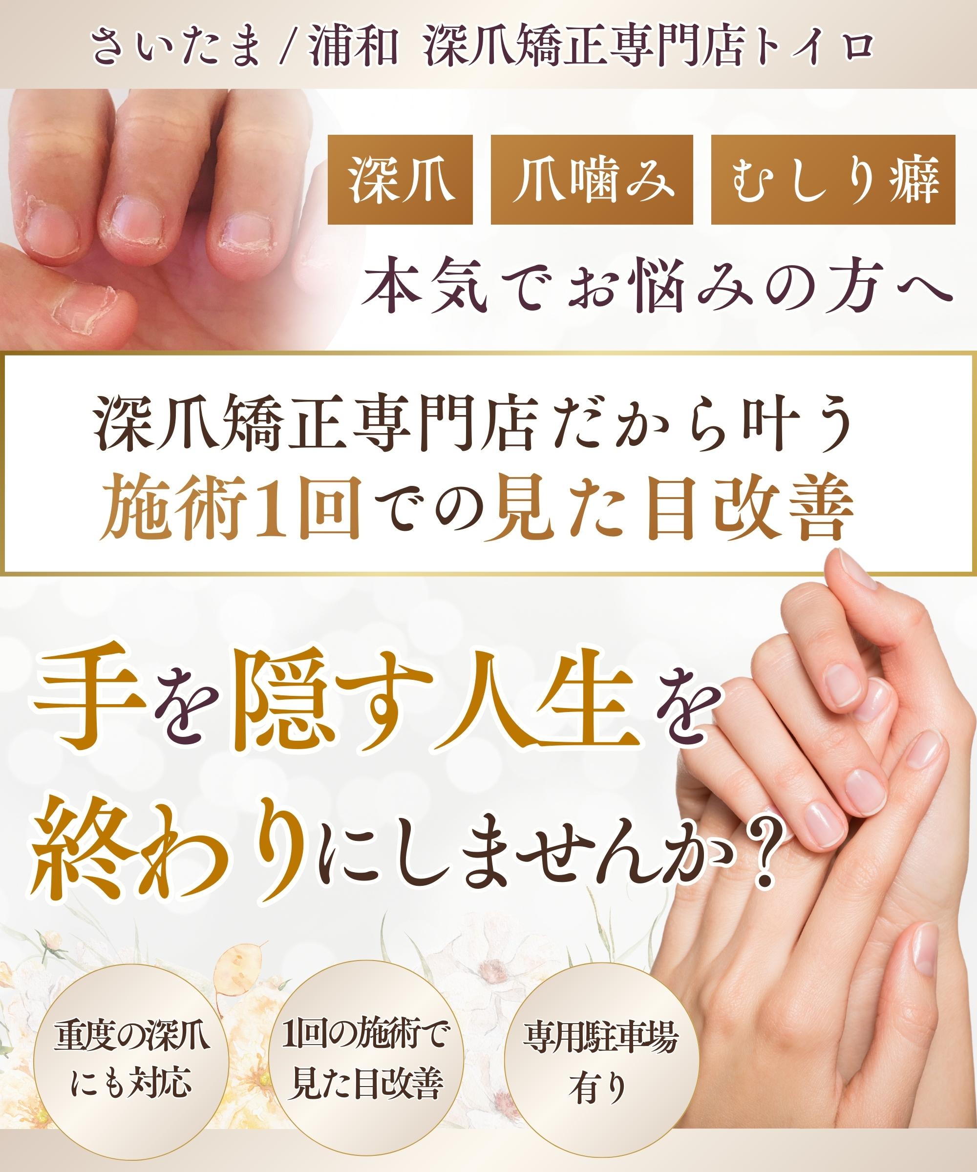 埼玉・さいたま市｜深爪矯正専門店 ネイルサロン トイロ